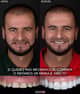 Slider image (7) Odontologia Laser